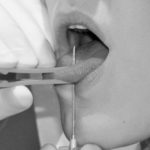 Galerie Piercings